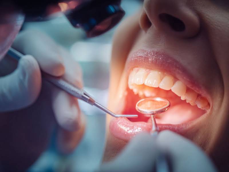 Стоматология по сложному удалению зуба Стоматология по сложному удалению зуба