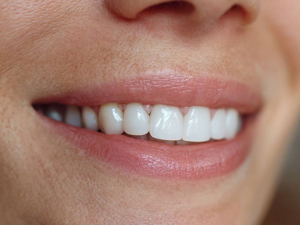 Ультразвуковая чистка зубов