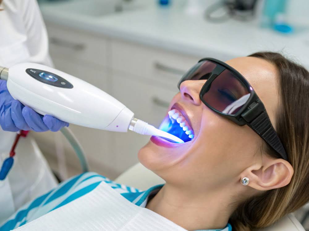 Отбеливание зубов Opalescence