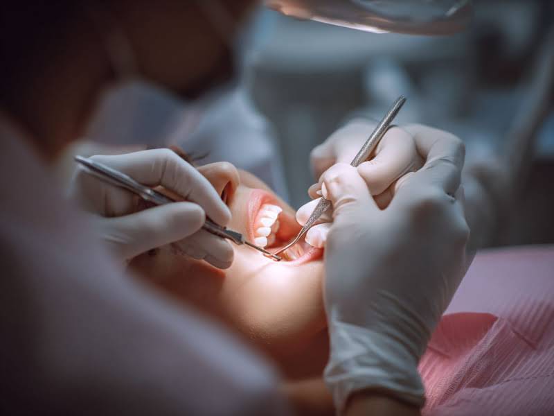 Отбеливание зубов Zoom Отбеливание зубов Zoom