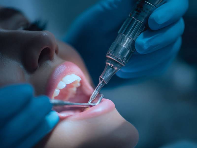 Лечение зубов в г.Электросталь