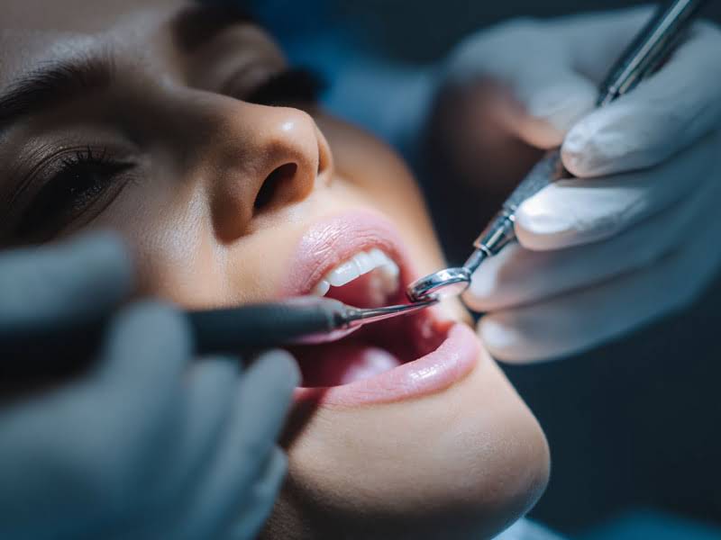 Сложное удаление зубов