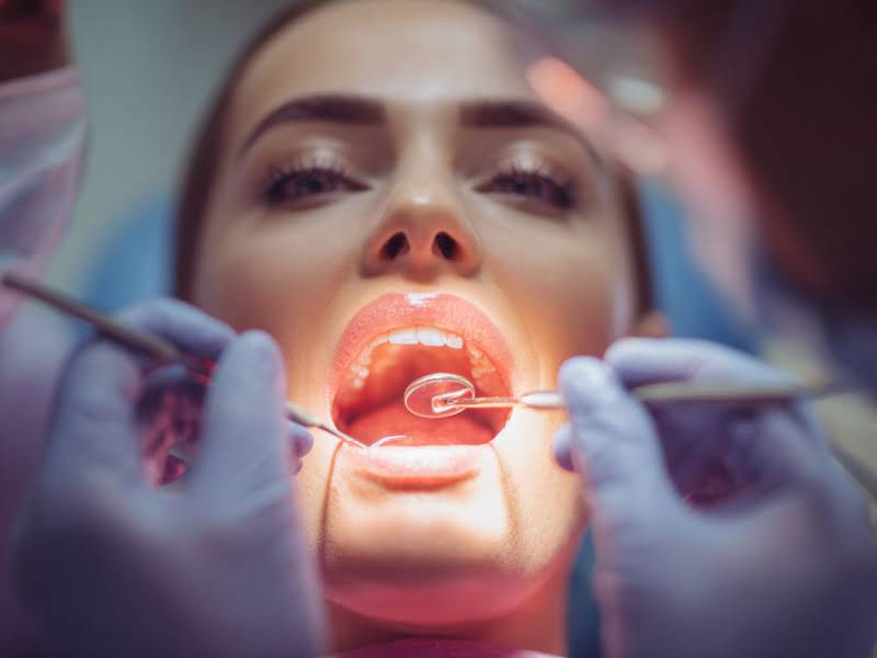 Лечение кариеса в Электростали недорого