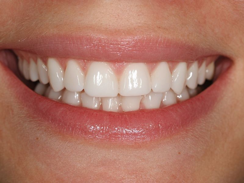 Сколько стоит профессиональная чистка зубов в Электростали